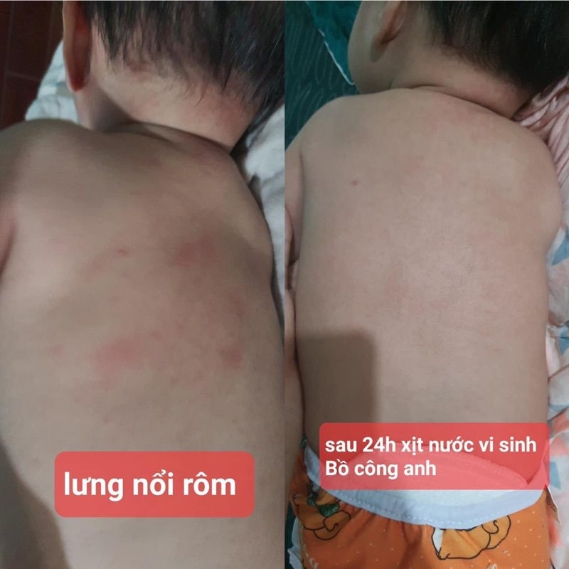 Nước lên men thảo mộc Bồ Công Anh - Vạn Đại