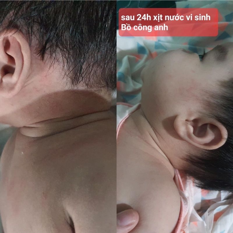 Nước lên men thảo mộc Bồ Công Anh - Vạn Đại
