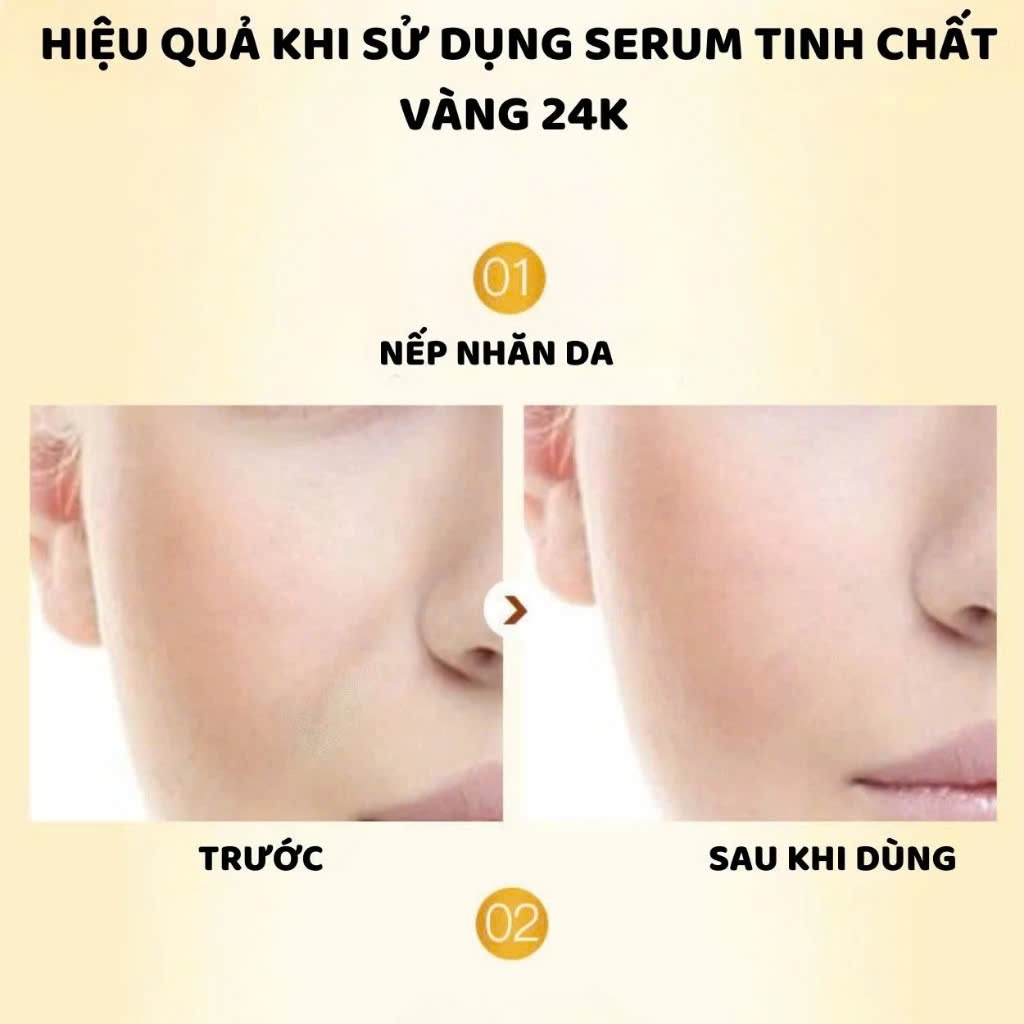 Ảnh Tinh chất Serum ENZO, Serum trắng da dưỡng ẩm chống lão hóa da, 100ML 4