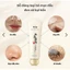 Gel Lột Mụn Nám Nhân Sâm Hàn Quốc Đào Thải Mụn Nám, Tàn Nhang và Kích Trắng Da , Phục Hồi Da Bị Lão Hoá