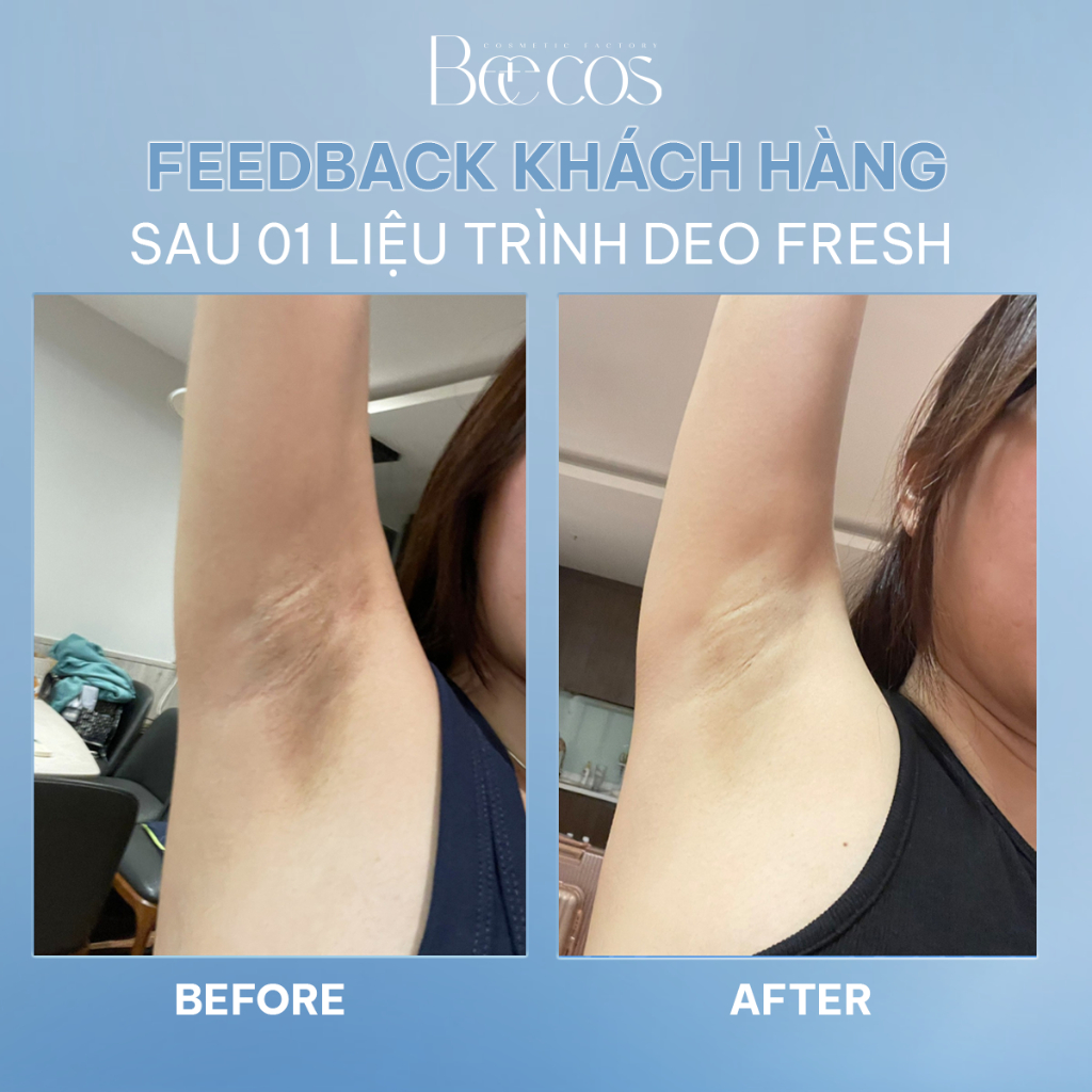 [Chính Hãng] Combo 20 Gạc lau khử mùi và giảm tiết mồ hôi nách, tay, chân, hỗ trợ dưỡng sáng Beecos