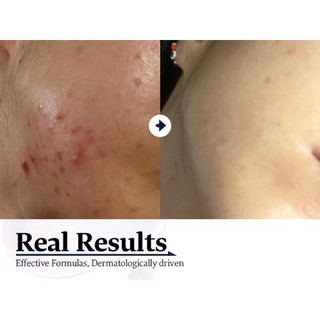 Celladix] Tinh chất cân bằng bã nhờn,mụn RX 131 Ampoule 20ml