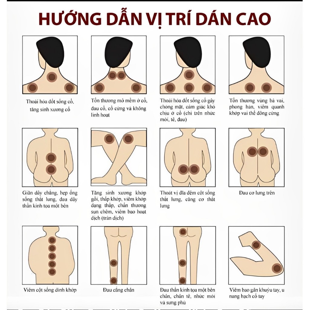 Miếng Dán Tiêu Chuẩn - cao dán cụ tòng thoát vị đĩa đệm
