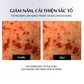 Tinh Chất Trắng Da Từ Sữa Lừa Arocell Milky Drop Finish Ampoule 30ml
