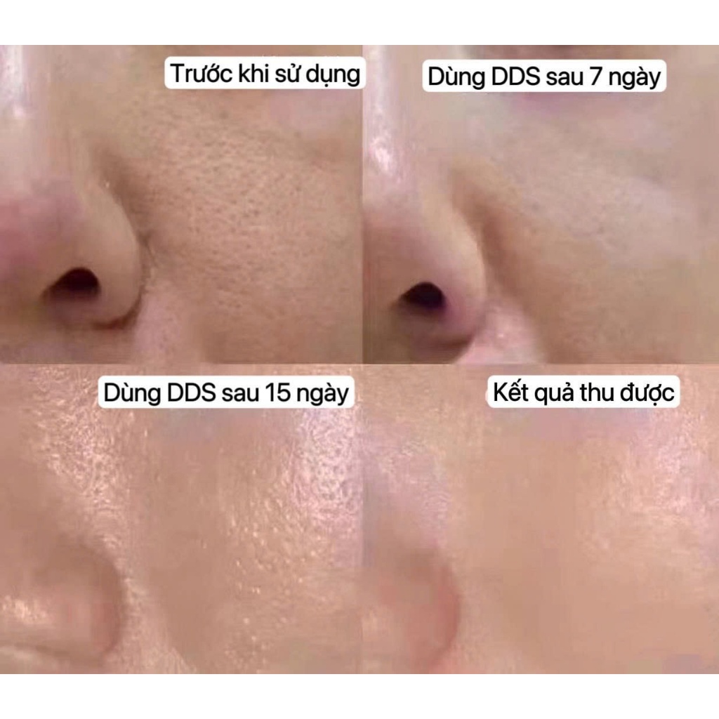 Serum sụn mũi cá hồi DDS Richness Capsule của Nhật 48 viên
