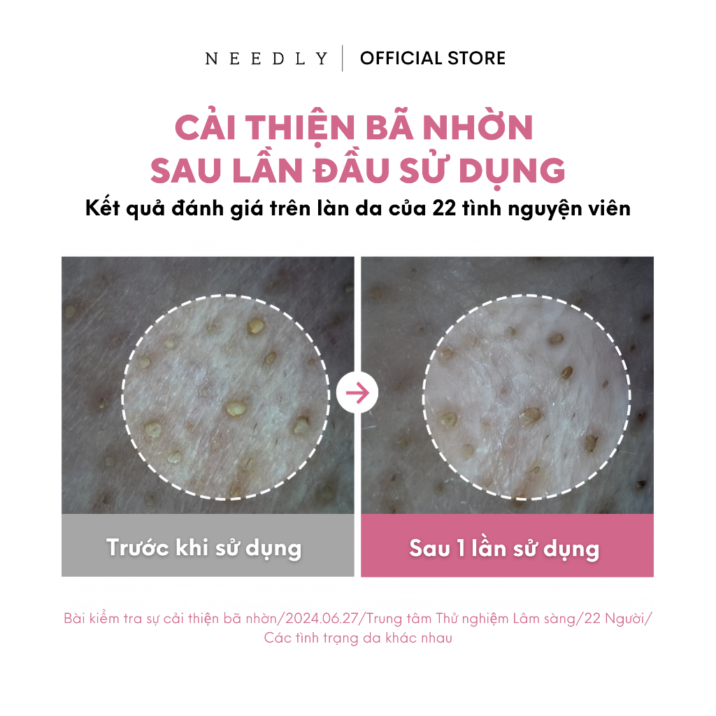 Ảnh Combo Chăm Sóc Tóc Toàn Diện Mộc An 3 Sản Phẩm Chiết Xuất Thảo Mộc, Tóc Chắc Khoẻ Giảm Gãy Rụng 4