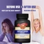 Melatonin: Giảm tác động của lệch múi giờ sau các chuyến bay dài, khôi phục nhịp sinh học tự nhiên