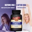 Melatonin: Điều chỉnh nhịp điệu ngày đêm, hỗ trợ lối sống khoa học và giảm rối loạn giấc ngủ 60 viên