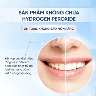 Máy Làm Trắng Răng SMILEKIT S5 Giúp Răng Trắng Sáng, Không Gây Ê Buốt, Chắc Khỏe Từ Sâu Bên Trong