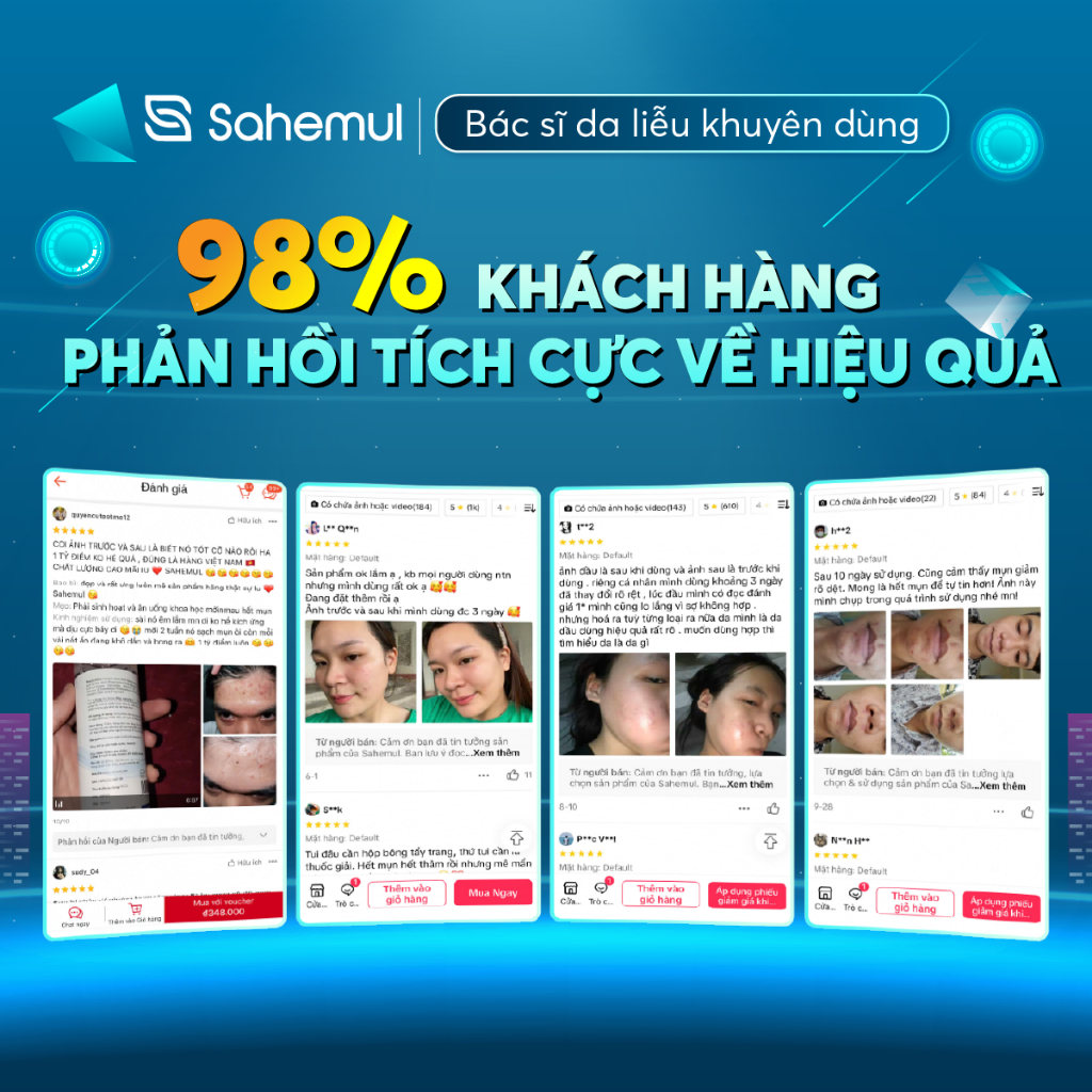 Ảnh Kem Mụn Sahemul Dùng Cho Mụn Viêm, Mụn Bọc, Mụn Mủ, Mụn Trứng Cá 20gr 3
