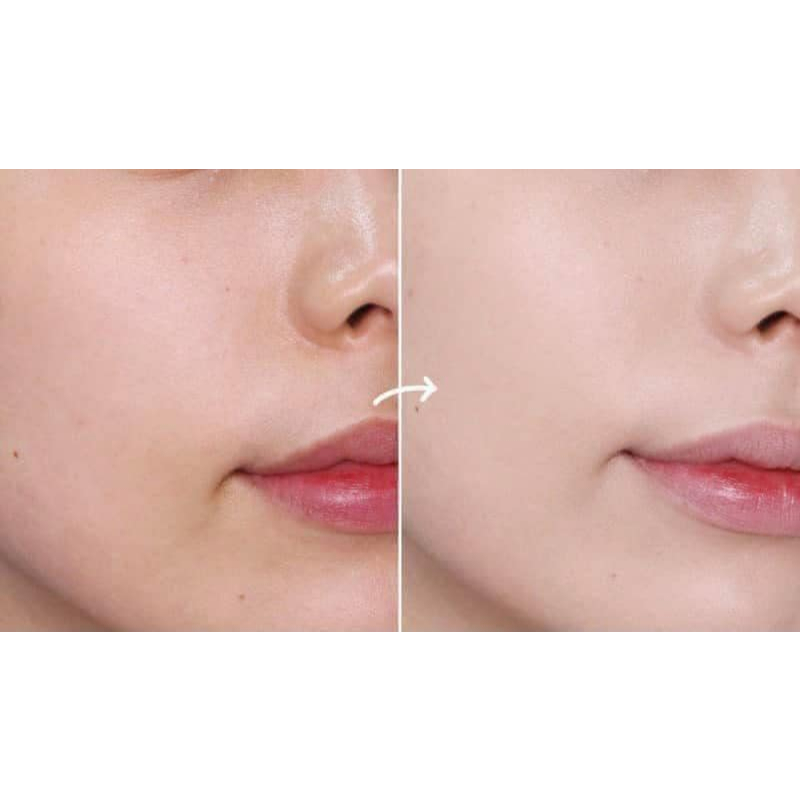(mẫu mới) Cushion / Phấn nước Renoderm Day Long BB Cream 15g