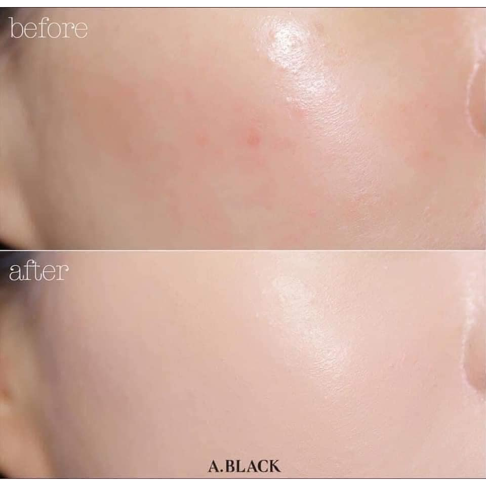 (mẫu mới) Cushion / Phấn nước Renoderm Day Long BB Cream 15g