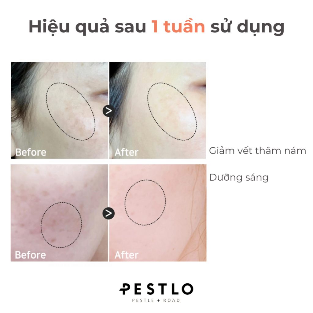 Kem dưỡng trắng PESTLO Rejurecipe TXA Cream 30ml [Date 29/01/2027]