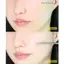 Hộp 5 Miếng Mặt Nạ Thạch Medianswer Collagen Mask Dưỡng Da Mềm Mịn 37g