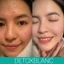 SERUM MỤN PEEL ACNES BLANC - H DETOXBLANC Hỗ trợ giảm các tình trạng mụn thâm