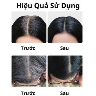Son Nhuộm Tóc Phủ Bạc Hết Hói Đầu Cho Tóc Dày Và Đều Màu Hơn