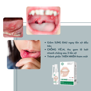 Xịt Hết Nhiệt Miệng, Giảm Viêm Lợi Làm Dịu cơn đau nhiệt miệng Chống Viêm Lở Loét