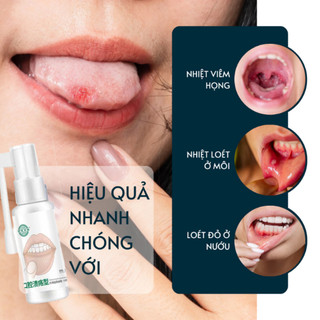 Xịt Hết Nhiệt Miệng, Giảm Viêm Lợi Làm Dịu cơn đau nhiệt miệng Chống Viêm Lở Loét
