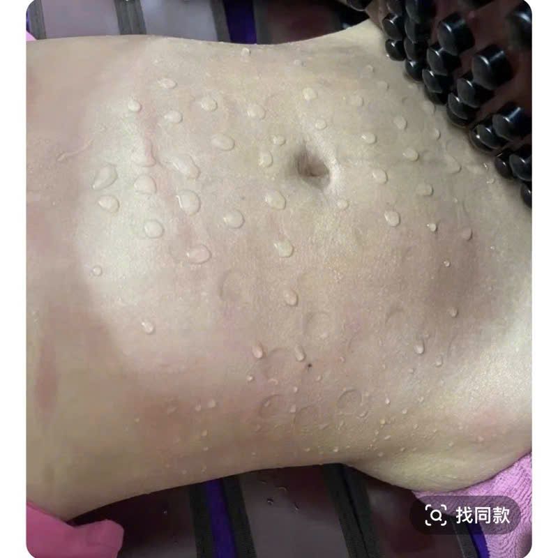 MÁY HOÁ LỎNG MỠ  - MÁY GIẢM BÉO CAO CẤP