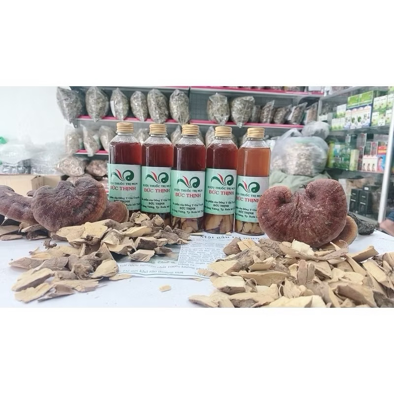 SỈ 5 Chai rượu rễ cây dùng cho da chai lì | Shopee Việt Nam