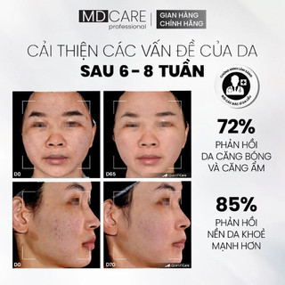 Tẩy Tế Bào Chết Làm Sáng, Mờ Thâm Và Đều Màu Da MD Care Glow Exfo 30ml