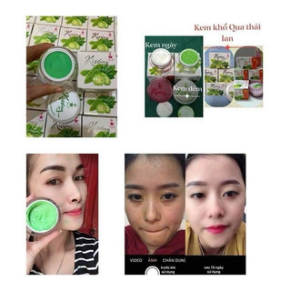 Kem Khổ Qua Kissing 20gram Thái Lan (Cam Kết Chính Hãng) - Mẫu Mới Nhất 2022