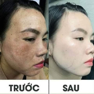 Kem Khổ Qua Kissing 20gram Thái Lan (Cam Kết Chính Hãng) - Mẫu Mới Nhất 2022