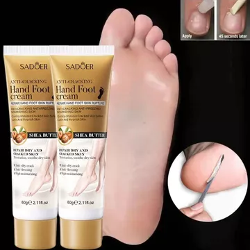 Kem nứt gót chân kem bôi nứt gót chân Kem Dưỡng Ẩm Chống Nứt Nẻ Gót Chân