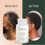 NOOR HAIR, Thực phẩm bổ sung giúp tóc mọc dày và nhanh,chống rụng tóc