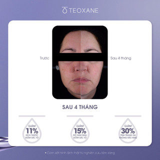 [Date 10/2026] Kem dưỡng da ban đêm - Teoxane Brightening Night Peel -  Làm sáng da - 15% Glycolic acid