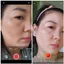 SERUM NÁM DETOXBLANC ESSENCE PEPTIDE XÓA SẠM NÁM, TÀN NHANG TRẮNG DA 20ml