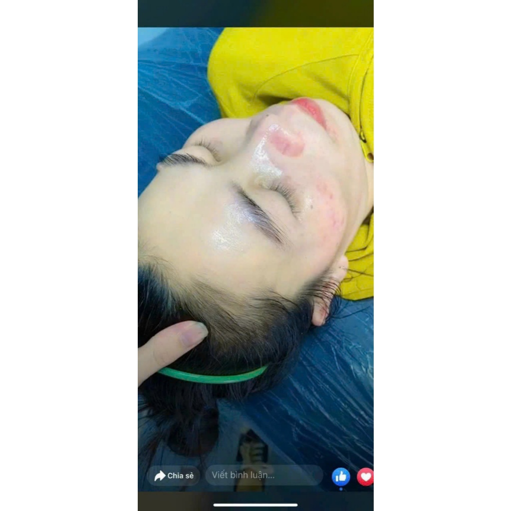 Kem Dưỡng Trắng Da MeSo Siêu Căng Bóng Da, Tái Tạo Da Mịn Màng, Mờ Thâm Nám Tàn Nhang Dưỡng Ẩm Da Mướt Hủ 30gr