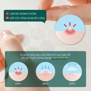 (Mẫu mới) Miếng Dán Some By Mi làm sạch Mụn Thần Kỳ Cho Mọi Loại Da Spot Patch
