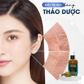 M23 - Peel  tài tạo da Thảo Mộc Lkaori (Chính Hãng)