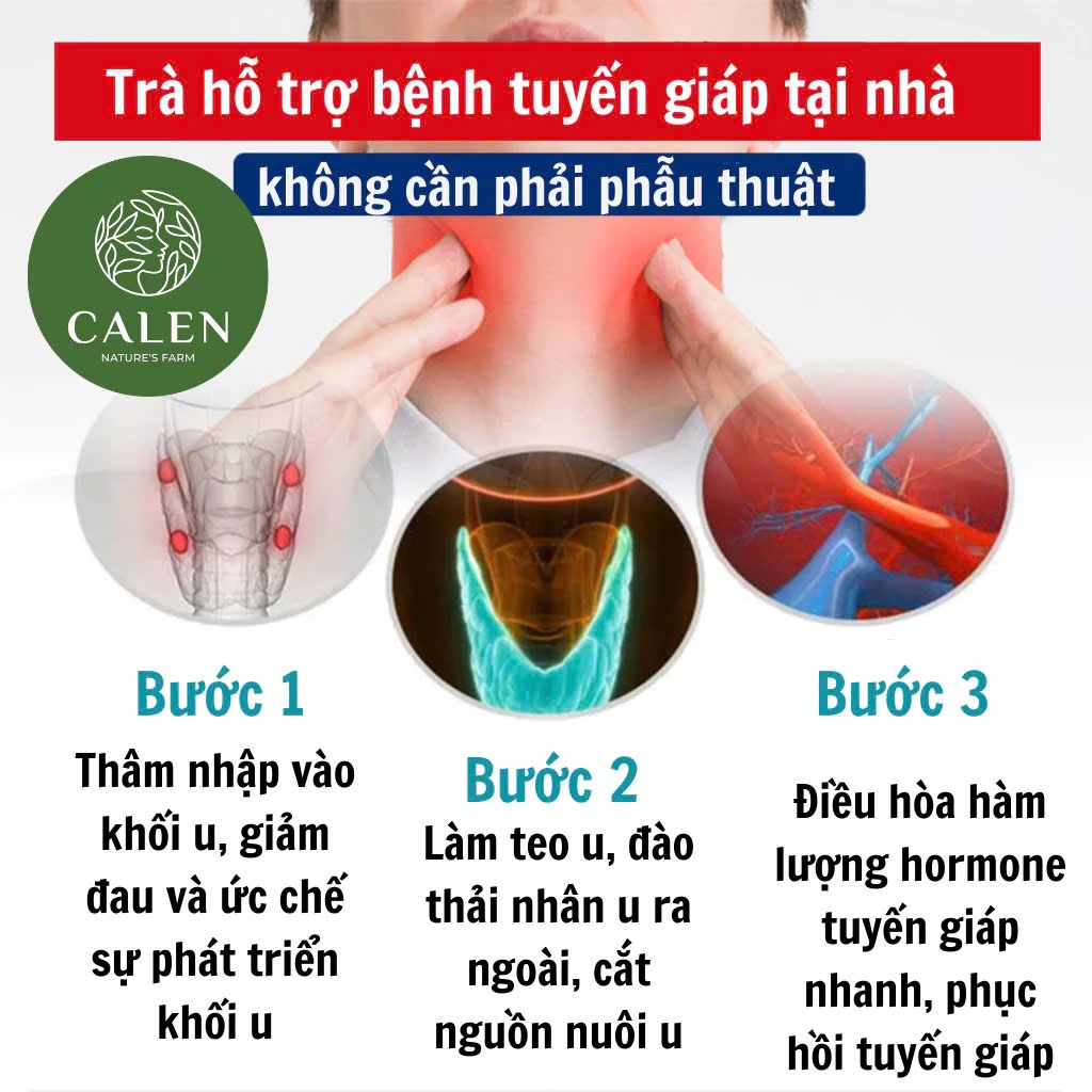 Trà tiêu u Calen hỗ trợ người bị u, xơ, nhân, nang, tuyến giáp, v.ú hiệu quả, giảm sưng và tăng đề kháng bịch 30 túilọc