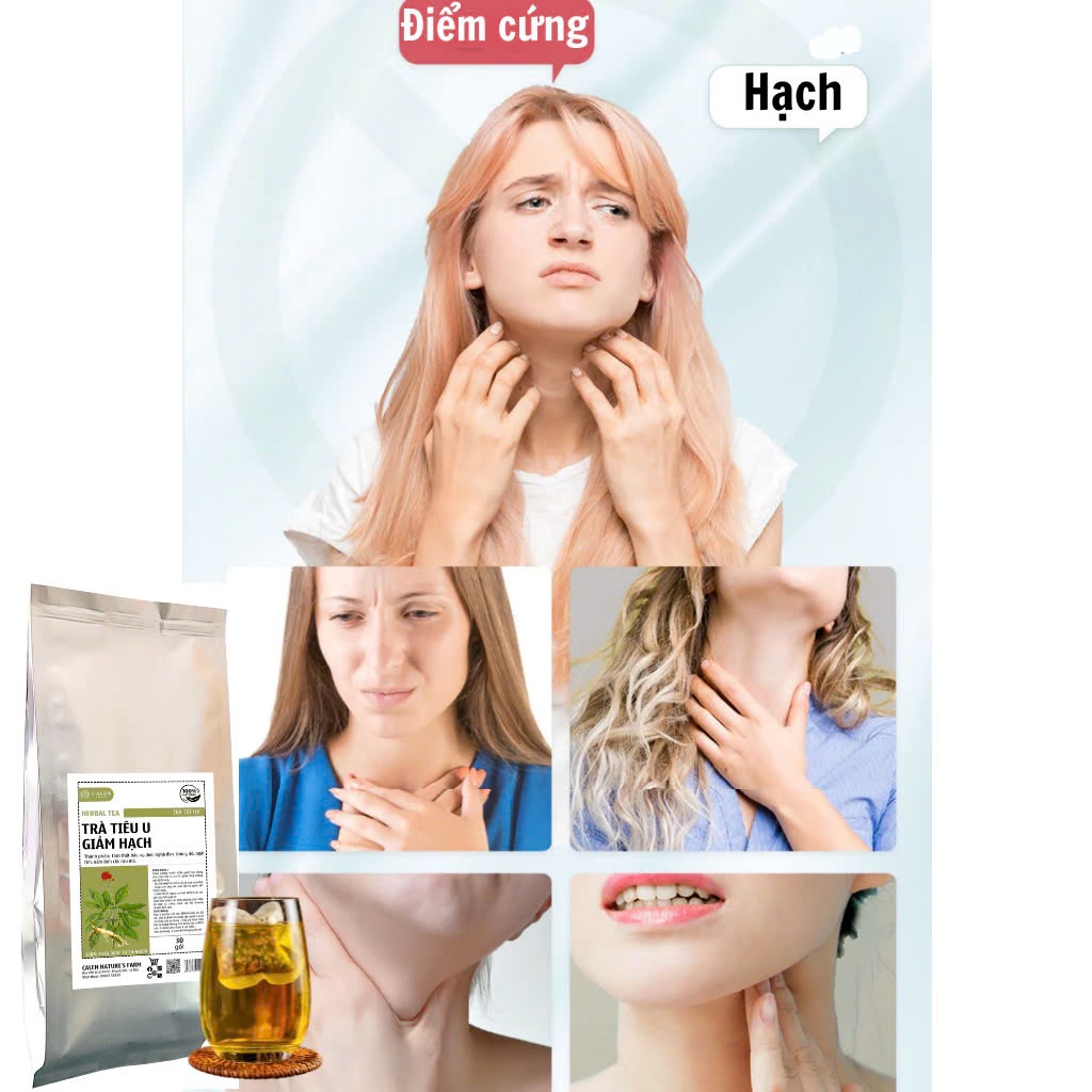 Trà tiêu u Calen hỗ trợ người bị u, xơ, nhân, nang, tuyến giáp, v.ú hiệu quả, giảm sưng và tăng đề kháng bịch 30 túilọc