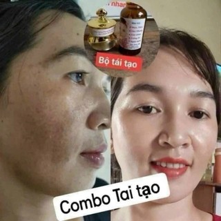 Combo 2 hộp kem face tách lẻ tái tạo da gia truyền đông y Giúp Da Căng Bóng Mịn Màng Sạch Nám Mụn Tàn Nhang