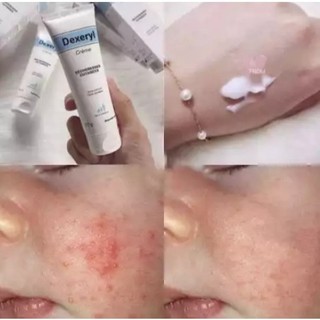 Kem Dưỡng Dexeryl Cream Dưỡng Ẩm, Dưỡng Da Cho Da Khô, Nẻ 50g 250g
