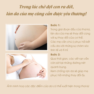 Kem Rạn Da Cho Bà Bầu ATONO2 Giúp Chống Rạn Da Trước Và Sau Sinh Giảm Mờ Thâm Sẹo 200ml