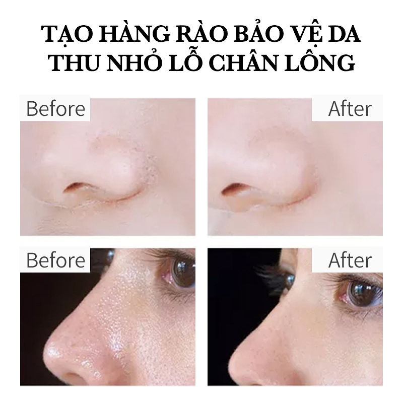 Serum AHA - BHA Tẩy da Chết, Giảm mụn thâm viêm,  - ANHANH Thu Nhỏ Lỗ Chân Lông, cải thiện da sần sùi, kiềm dầu