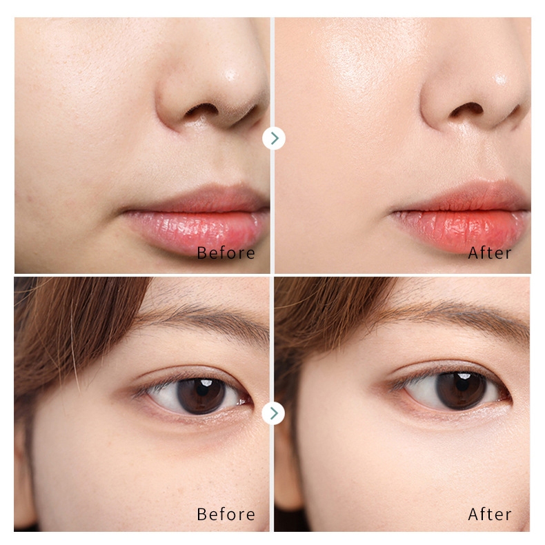 Serum AHA - BHA Tẩy da Chết, Giảm mụn thâm viêm,  - ANHANH Thu Nhỏ Lỗ Chân Lông, cải thiện da sần sùi, kiềm dầu