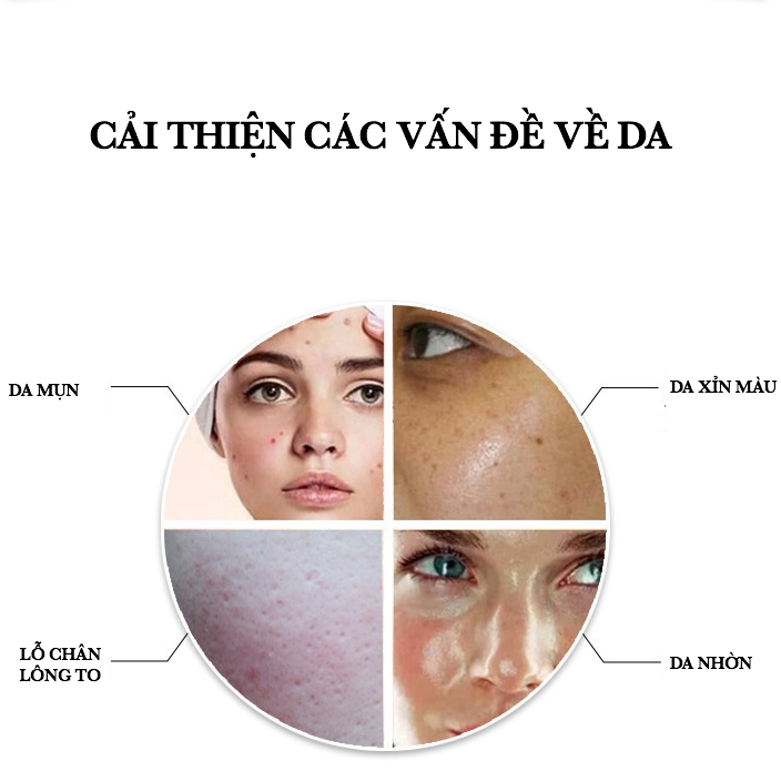 Serum AHA - BHA Tẩy da Chết, Giảm mụn thâm viêm,  - ANHANH Thu Nhỏ Lỗ Chân Lông, cải thiện da sần sùi, kiềm dầu