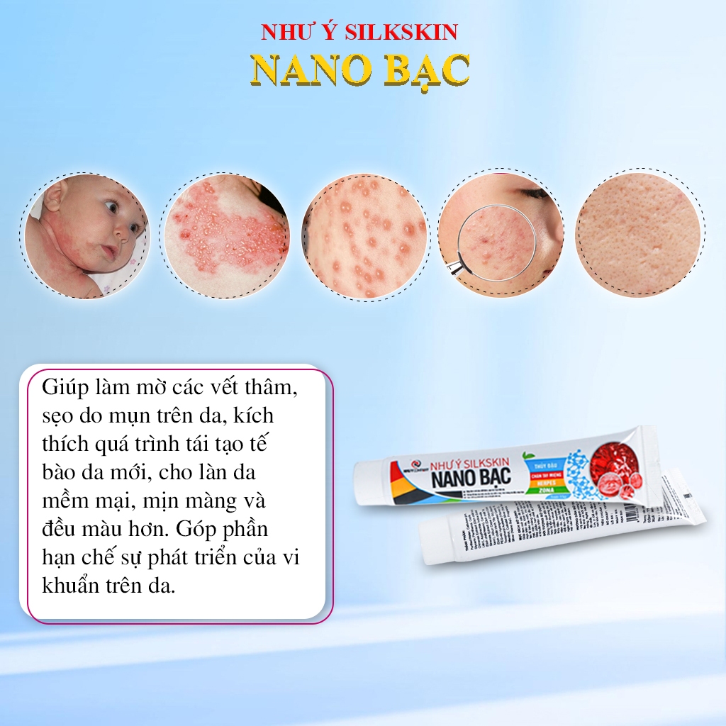 Kem bôi Như Ý Silkskin Nano bạc (Hộp 1 Tuýp 15gr)