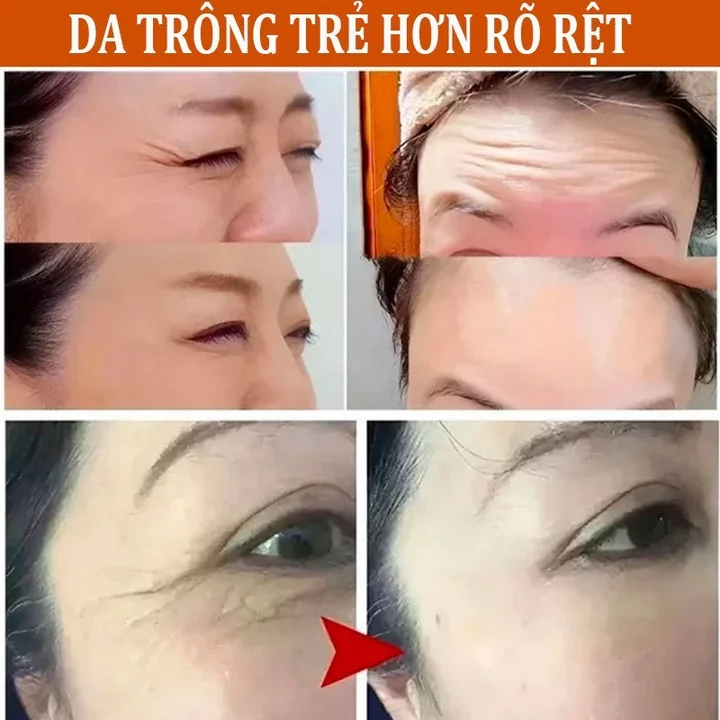 Serum chống lão hoá serum trắng da serum dưỡng da 100ml serum se khít lỗ chân lông tinh chất dưỡng giảm thâm nám