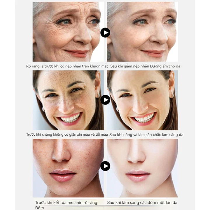 Serum chống lão hoá serum trắng da serum dưỡng da 100ml serum se khít lỗ chân lông tinh chất dưỡng giảm thâm nám