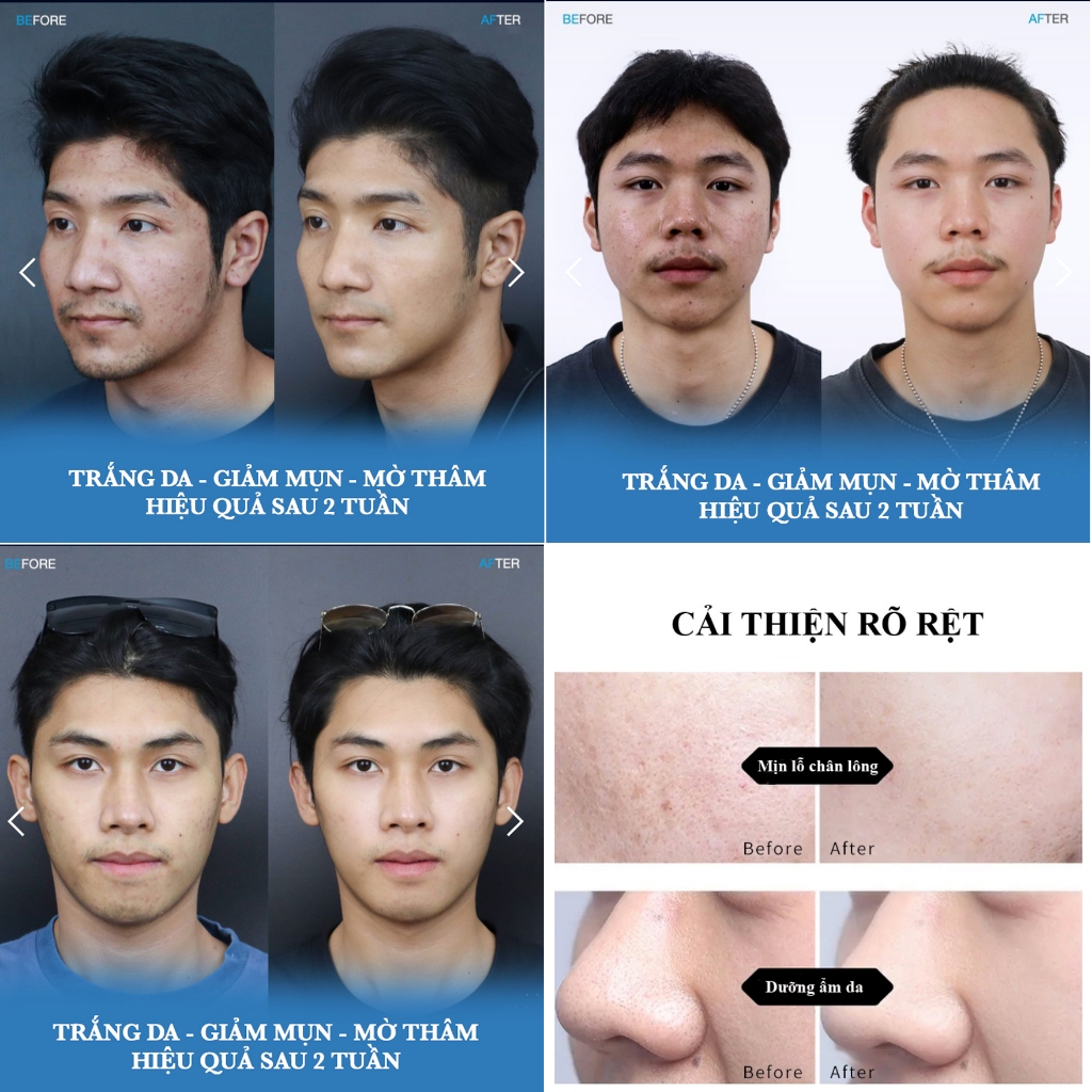 Super Serum Trắng da cho nam -  ANHANH - làm sáng da, mờ thâm dưỡng ẩm, làm săn chắc da mặt