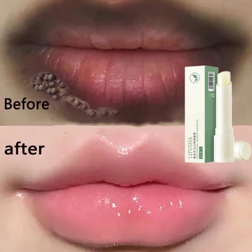 Khử Thâm Môi Son Dưỡng Môi Làm Mềm Môi Cải Thiện Tình Trạng Môi Thâm Sạm,nhỏ và dễ dàng,mang theo làm mềm da chết 3g