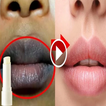 Khử Thâm Môi Son Dưỡng Môi Làm Mềm Môi Cải Thiện Tình Trạng Môi Thâm Sạm, Mặt Nạ Ngủ Môi Dưỡng Ẩm,Khô Nứt Thiếu Sức Sống