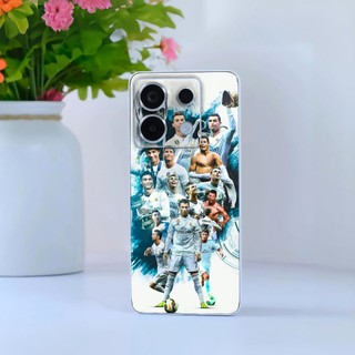 Miếng dán Skin Mặt lưng sau full viền Xiaomi Redmi Note 13 Pro 5G , 12 Turbo ,K70 Pro , K40 Pro K50 , K60 , Turbo 3