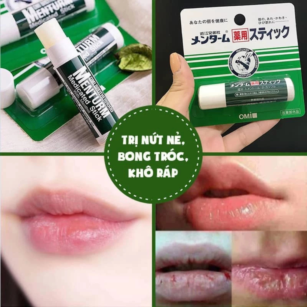 Son Dưỡng Ẩm Bạc Hà Dành Cho Môi Khô Và Nứt Nẻ Omi Brotherhood Menturm Nhật Bản 4g | BigBuy360 - bigbuy360.vn